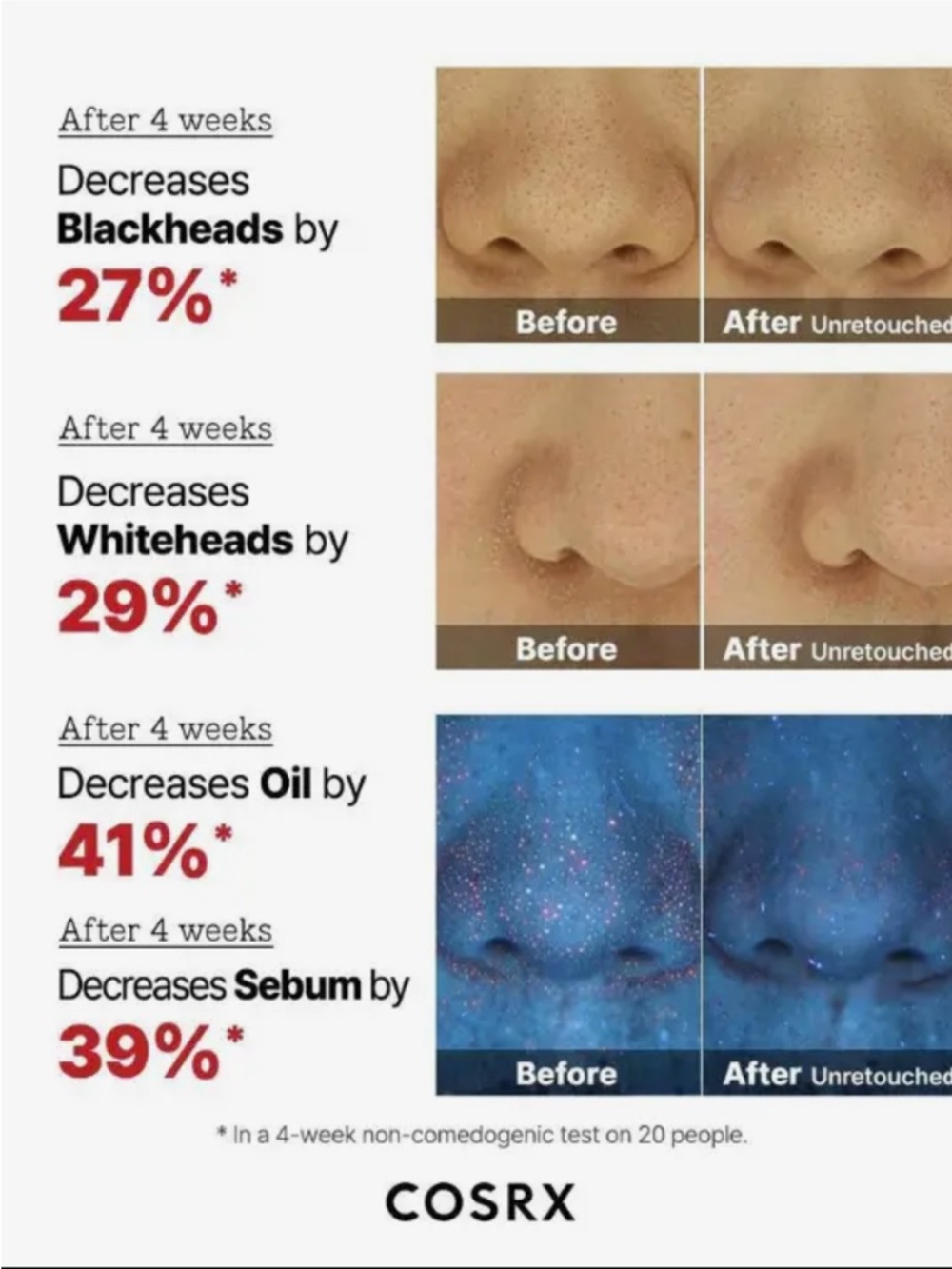 Cosrx The AHA 2 BHA 2 Blemish Treatment Serum - Picture 8 of 10